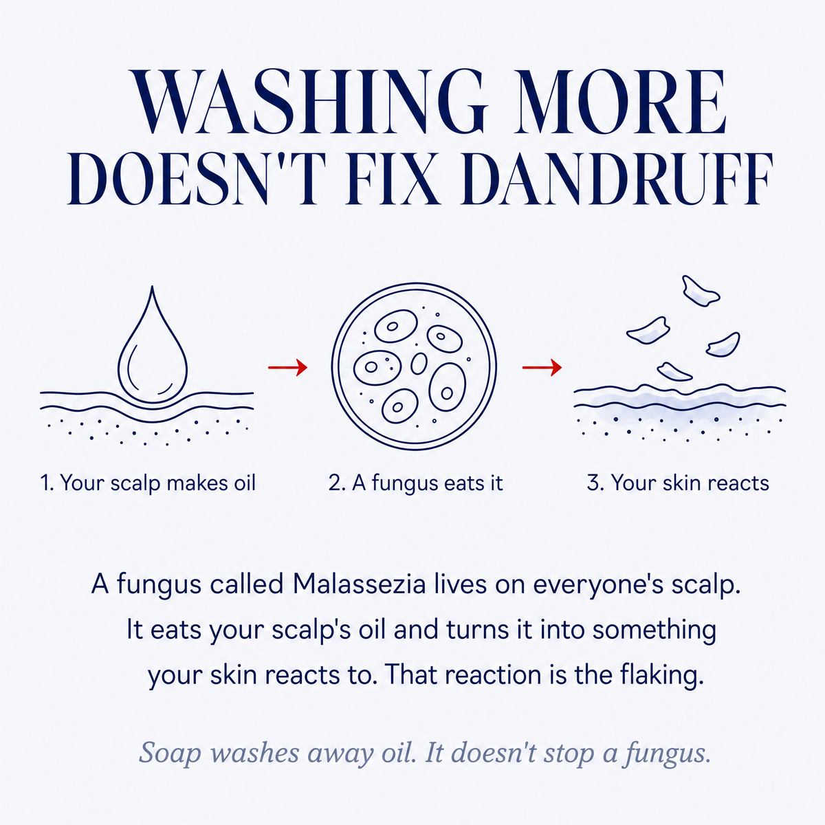 Anti-Dandruff Shampoo