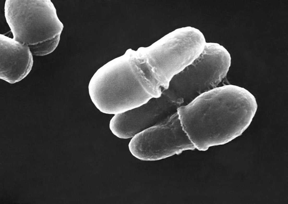 Malassezia yeast cells under an electron microscope